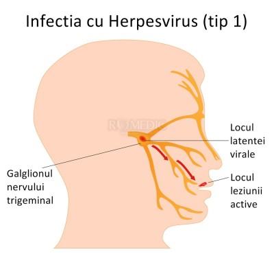 virusul herpes provoacă pierderea în greutate)